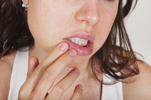 Mouth Sore woman Fingers Pressing Lips